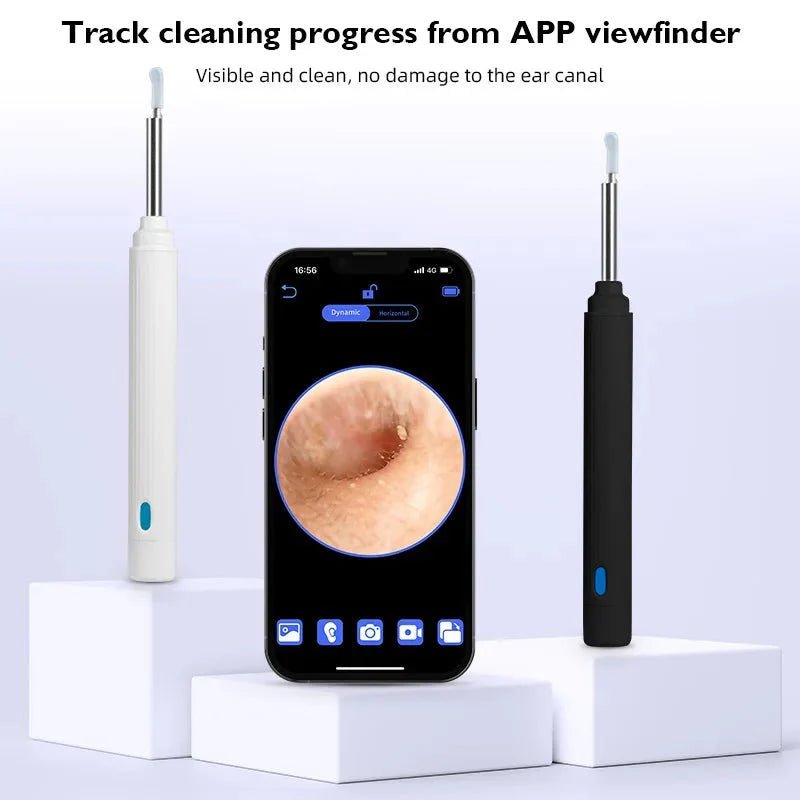 5MP HD Visual Ear Scope with LED Light | Smart Wireless Inspection Camera - GiftMira
