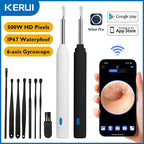 5MP HD Visual Ear Scope with LED Light | Smart Wireless Inspection Camera - GiftMira