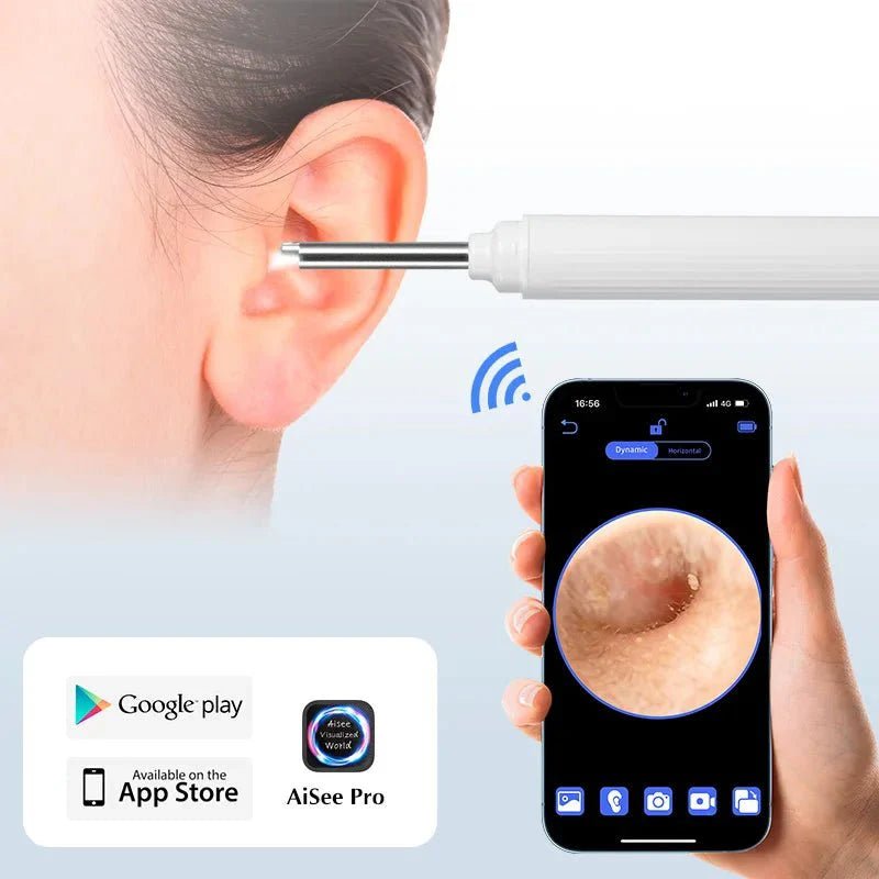5MP HD Visual Ear Scope with LED Light | Smart Wireless Inspection Camera - GiftMira