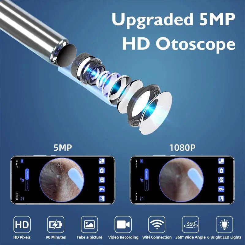5MP HD Visual Ear Scope with LED Light | Smart Wireless Inspection Camera - GiftMira