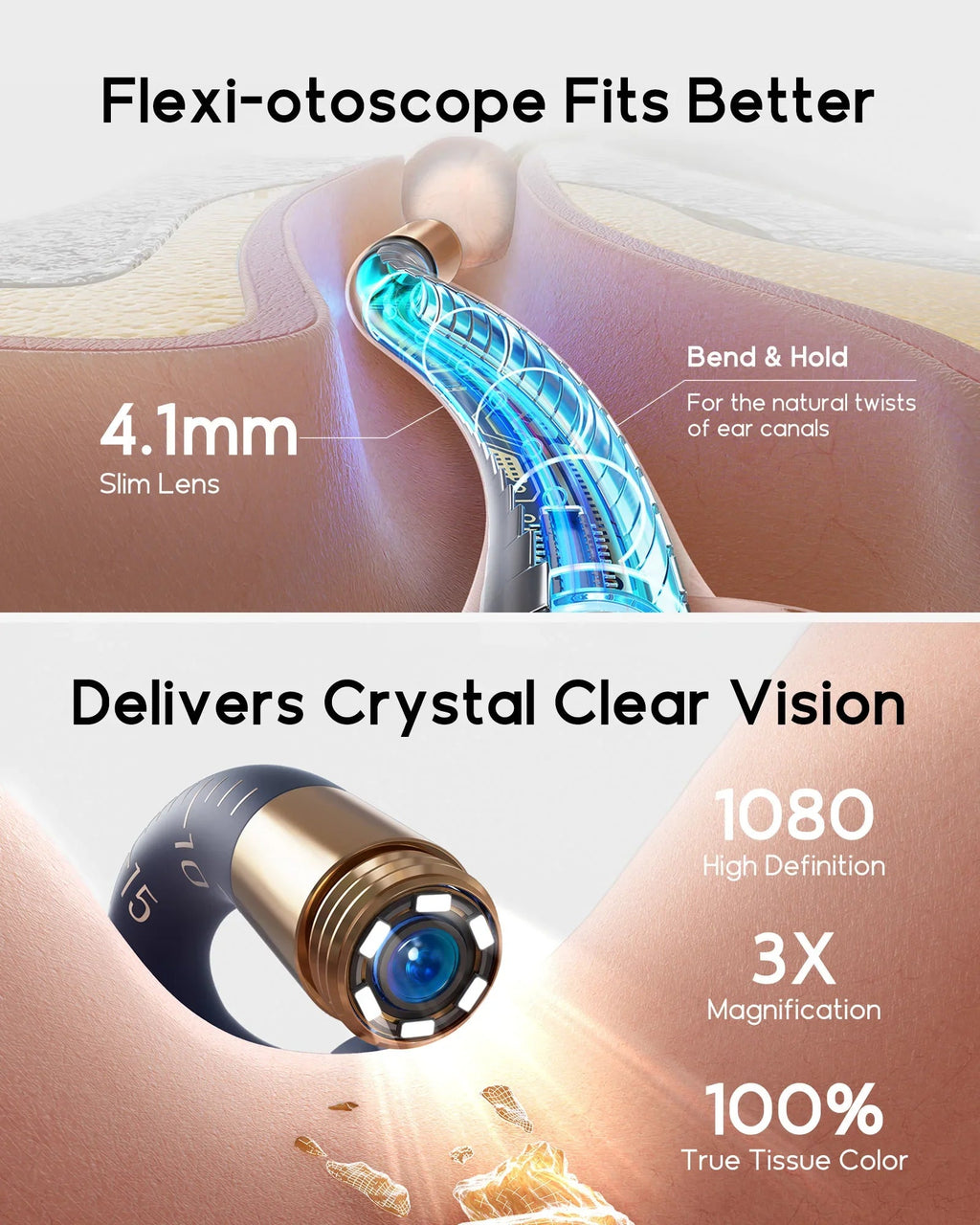 Bebird EarSight Plus I35R – All - in - 1 HD Visual Ear Camera & Cleaning Tool - GiftMira