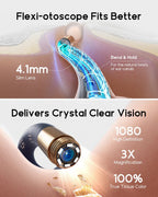 Bebird EarSight Plus I35R – All - in - 1 HD Visual Ear Camera & Cleaning Tool - GiftMira