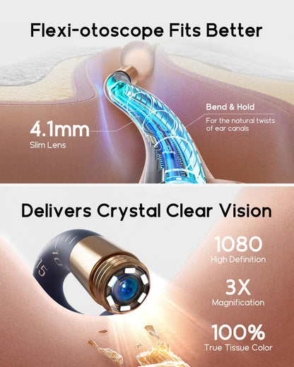 Bebird EarSight Plus I35R – All - in - 1 HD Visual Ear Camera & Cleaning Tool - GiftMira